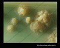 mycobacterium tuberculosis close-up